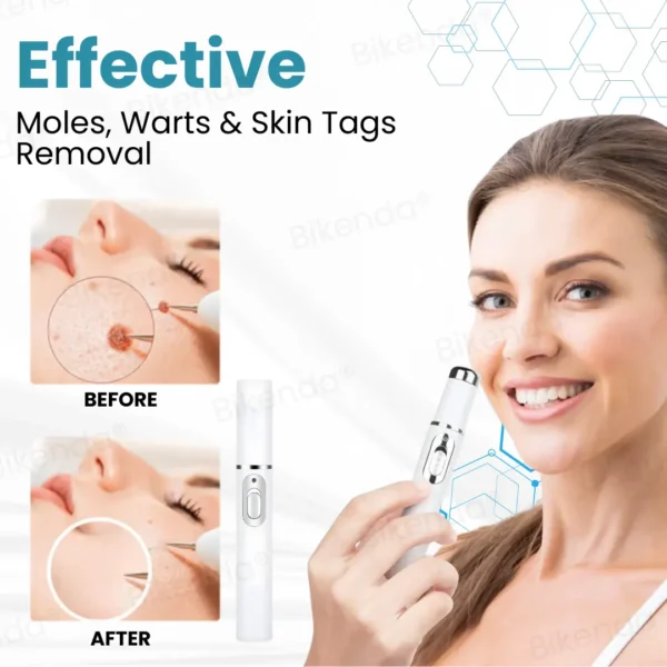 Bikenda® Non-invasive Mole and Wart